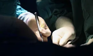 Thoát vòng luẩn quẩn đau nửa đầu sau hơn 20 năm